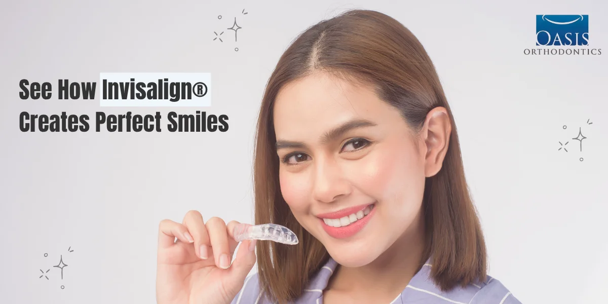 How Does Invisalign Work