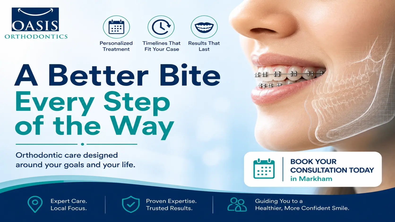 How Long Does an Underbite Take to Fix with Braces