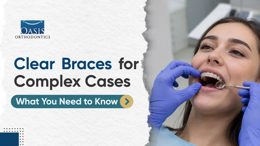 Can You Get Clear Braces for Complex Cases