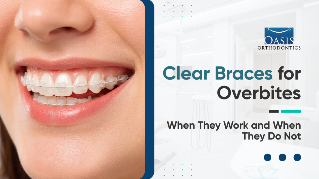 Do Clear Braces Work for Overbites