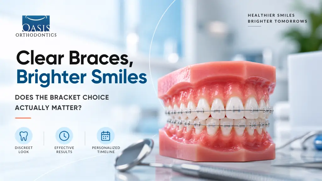 Do Clear Braces Take Longer Than Metal Braces